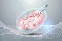 <b>做试管婴儿助孕胚胎培养多少天效果比较好?</b>