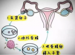 <b>试管婴儿移植周期的依据是什么?</b>