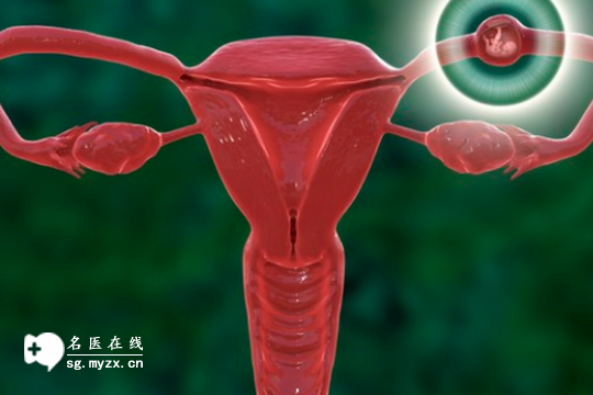 导致女性不孕的妇科疾病多，宫外孕、宫颈炎以及内膜异位症等等，你中招了没