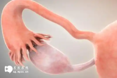 <b>输卵管粘连做试管婴儿技术是怎么取出卵子的？</b>