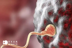<b>做试管婴儿是怎么把冻融胚胎放进子宫的，流程是什么？</b>