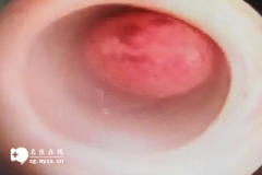 <b>31岁选择直接做试管还是宫腹腔镜手术哪种受罪更伤身体？</b>