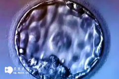 <b>做第三代试管婴儿检测囊胚基因时可以排除哮喘和心衰吗</b>