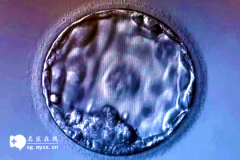 <b>子宫腺肌患者做二代试管婴儿移植囊胚会失败吗</b>