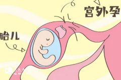 避免宫外孕做好这5项工作