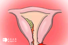 女性排卵期不排卵怎么回事？