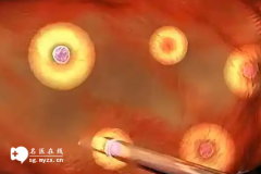 做试管婴儿取卵后第二个月月经40天没来正常吗