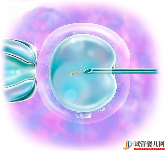 一、二、三代试管婴儿的优缺点,做试管婴儿应该选择...(图3)