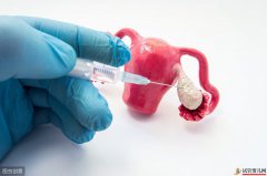 <b>听说试管婴儿促排卵会导致女性卵巢早衰？别再</b>