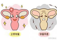 这些习惯伤害卵巢,你却不知道