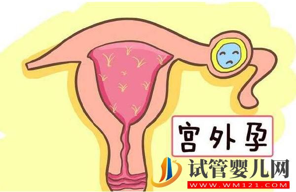 试管婴儿会发生宫外孕吗?到底能否避免呢(图1) 试管婴儿会发生宫外孕吗?到底能否避免呢