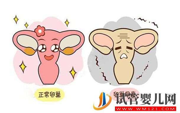 卵巢早衰去泰国做试管婴儿的成功率如何?(图2) 卵巢早衰去泰国做试管婴儿的成功率如何?