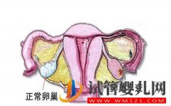 卵巢早衰备孕这么做