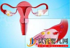 卵巢早衰怎样调理做试管？