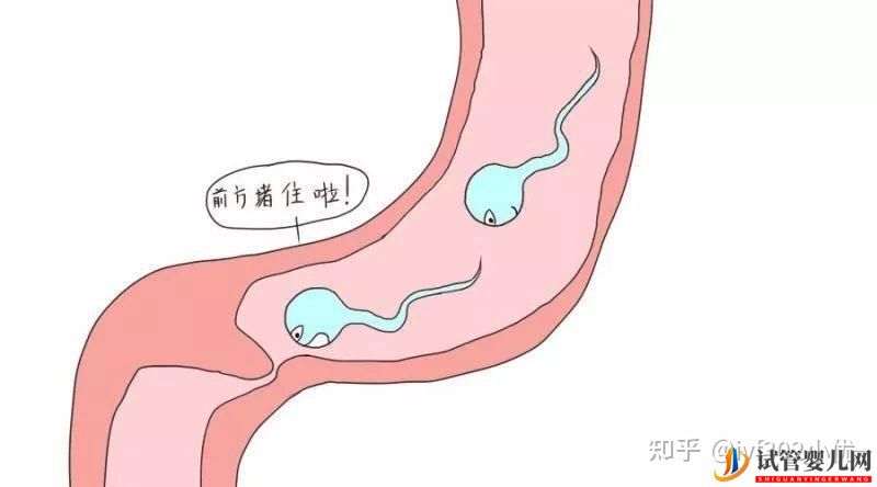 输卵管堵塞想做试管婴儿,拿到结果后我哭了(图3) 输卵管堵塞想做试管婴儿,拿到结果后我哭了(图3)